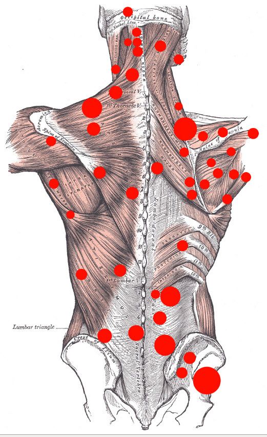 Foto di Masaj terapeutic ,(Deep Tissue)-Liliana