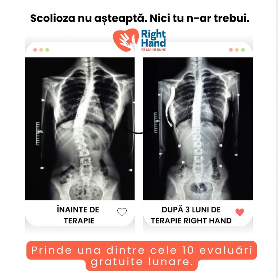 Photo of Recuperare Copii Right Hand